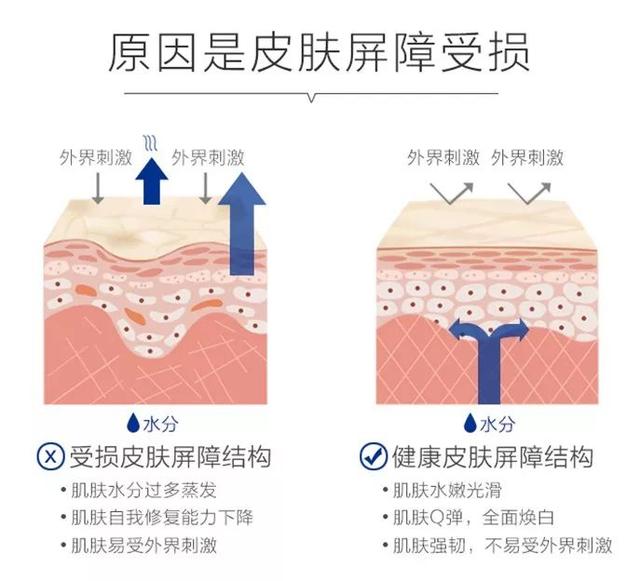 干货科普为何皮肤总是暗沉粗糙长痘痘原来都跟皮肤屏障有关