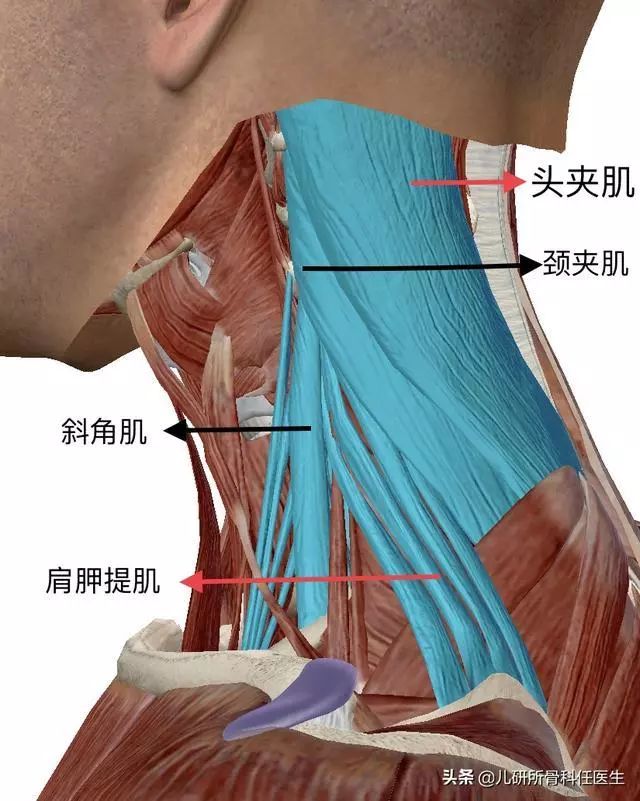 孩子突然歪脖子 儿童肌性斜颈与环枢椎半脱位的区别-图片4