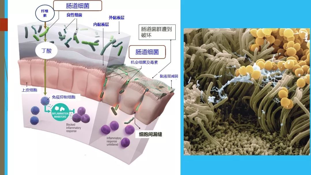 细说人体肠道菌群与免疫三者之间的恩怨情仇