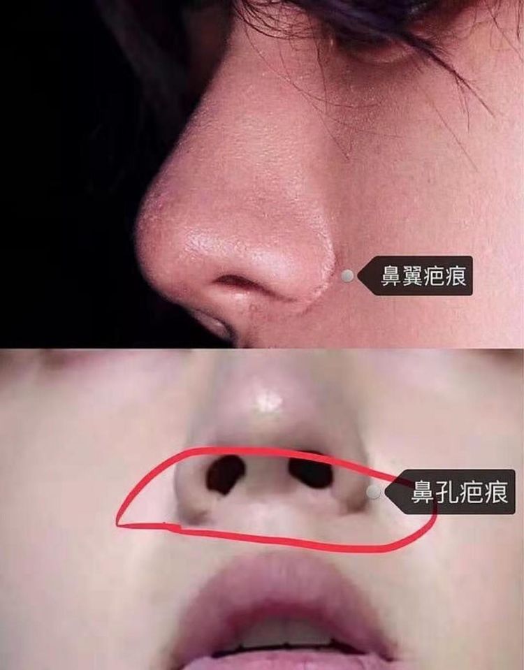 男星遭整容师怀疑整鼻子 称可以看的出动了鼻部 王一博