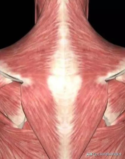 孩子突然歪脖子 儿童肌性斜颈与环枢椎半脱位的区别-图片2