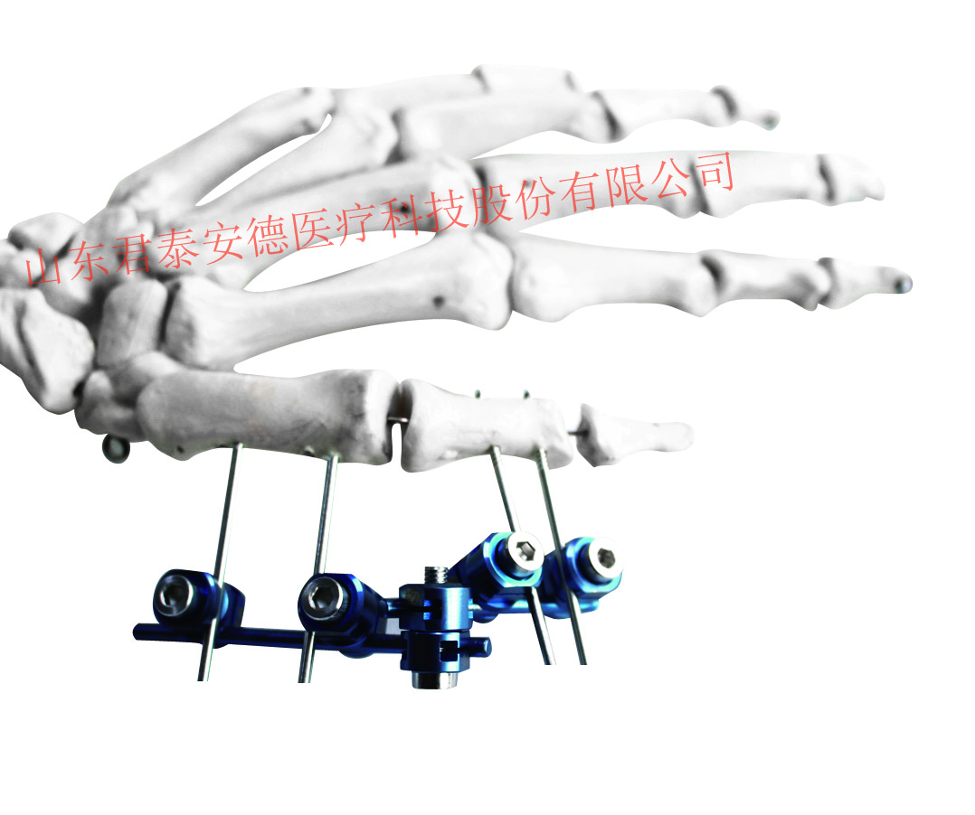 单边式外固定支架工具盒 腕关节 - 上海开为医药科技有限公司--创伤、肢体矫形技术解决方案的专业服务商
