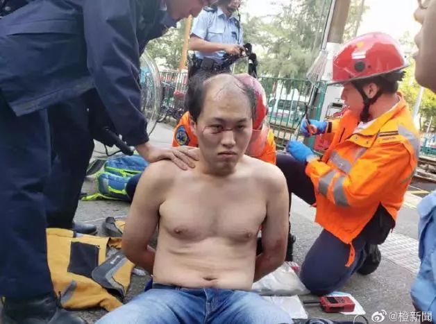 遇袭视频曝光，刀手太卑鄙！何君尧露面发声
