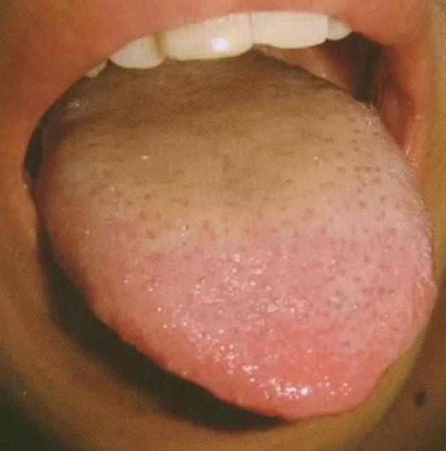 780c92c9f84840b8a639a5421057c1d1.jpeg