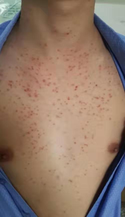 怎样才能长出毛囊 f4461eec7a024b31becca3b2eb5fcd88.jpeg