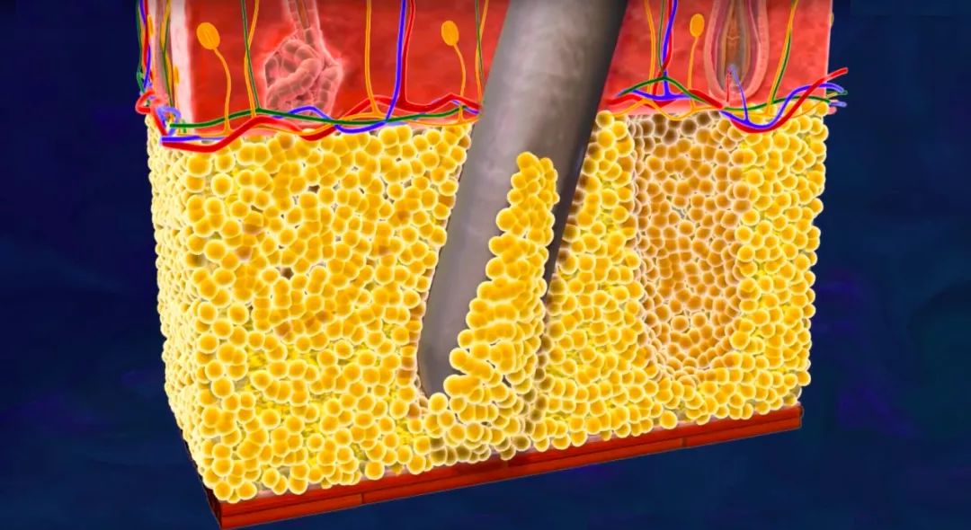 想一夜暴瘦,抽脂可行吗?