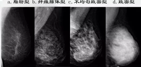 乳腺b超要脱内衣吗(2)