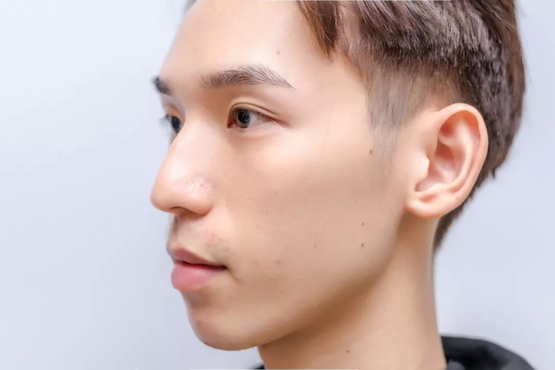 天天熬夜爆肝却还是牛奶肌,为啥现在男生皮肤比你还能