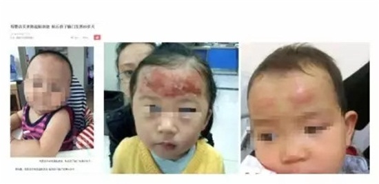 家家月嫂■“退热贴”坑了多少家长！你还在给孩子用吗？