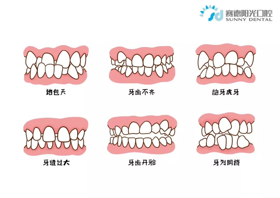 「央视少儿」等孩子牙齿出问题了，才知道这些，真是晚了！