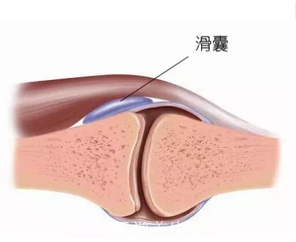 什么是滑膜炎 085d402d104d4c9684dfc0f47c8bf88d.png