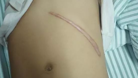 「河南圈」一3岁男童被同学称怪物，不敢去厕所，只因患了这病......