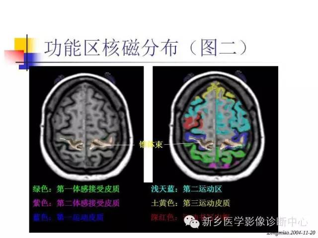 脑磁共振局部解剖功能图解