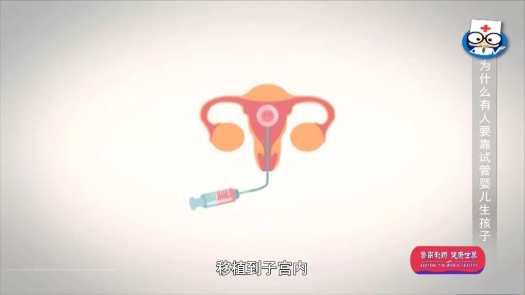 揭秘人工授精全过程