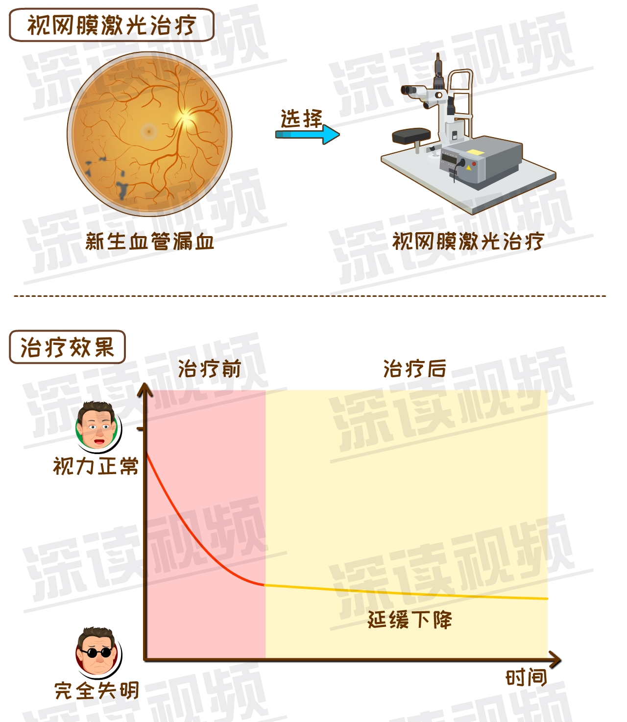 玻璃体切割手术的原理_175眼科玻璃体切割术的健康宣教