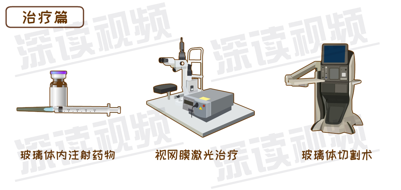 玻璃体切割手术的原理_175眼科玻璃体切割术的健康宣教