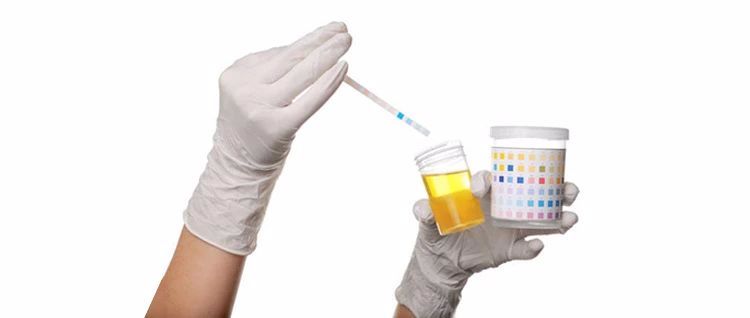 什么原因会引起尿微量蛋白高 d76a976883dc439398e9f946cb9c7d84.jpeg