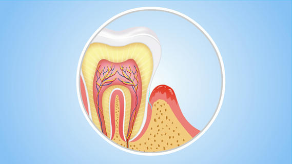 牙龈发痒是什么原因？