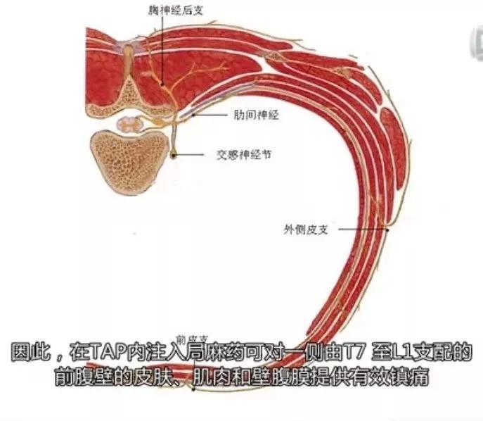 "超声引导下腹横肌平面阻滞"带你走进无痛世界