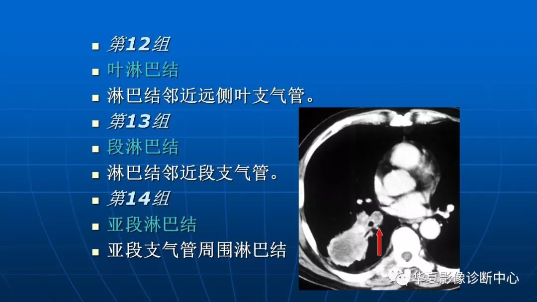 肺癌分期 纵隔淋巴转移ct展示