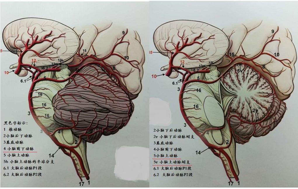 【纯干货】一文读懂小脑梗死的定位诊断