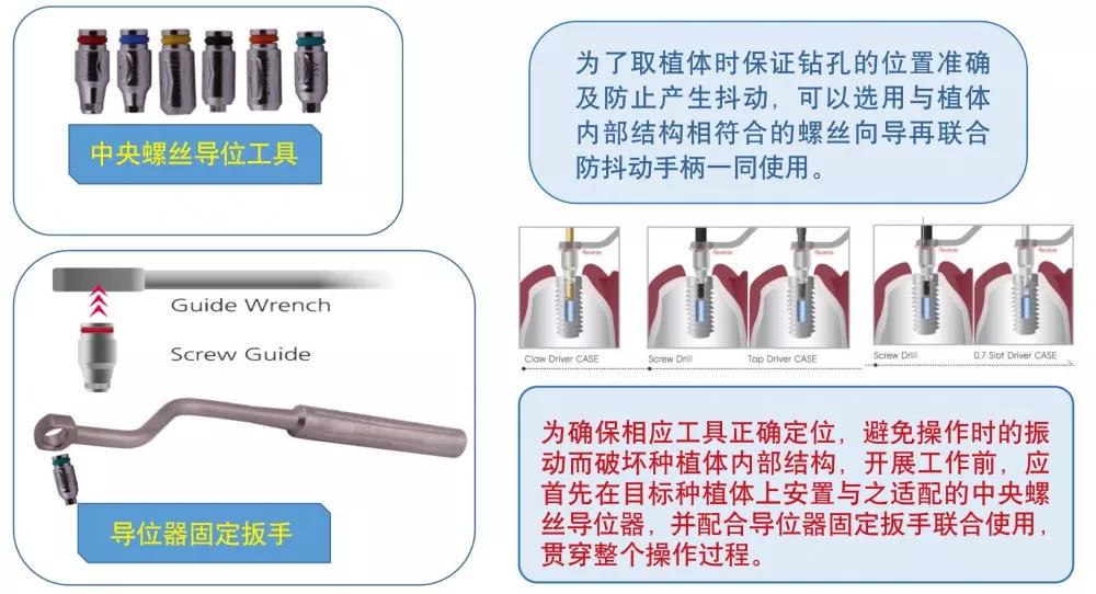 取折断中央螺丝临床病例取出种植体操作方法及顺序概要使用方法及操作