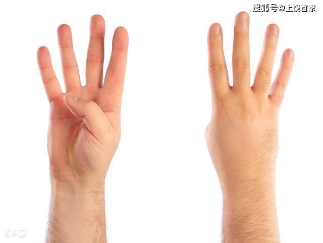 如何预防脑梗塞最好方法 3f27e10f0a45484eacbdda4632c8921a.jpeg