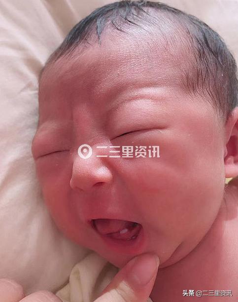 「沛沛情感」原创吉林这个女婴很奇特……刚出生就长两颗牙 妈妈喂奶被咬哭