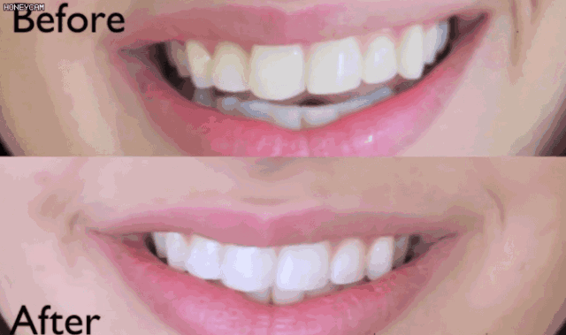 d19676bf732e4806b3b1a0187ac98835.gif