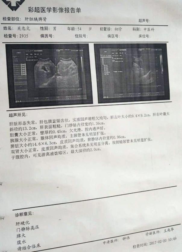 钟伟医生健康谈:医生,我检查出肝硬化腹水,还能活多久?