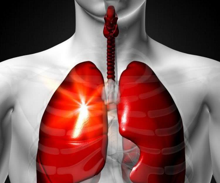 肺癌身体会变瘦吗 ae777222c52b49b098b23f2c321c2d2f.jpeg