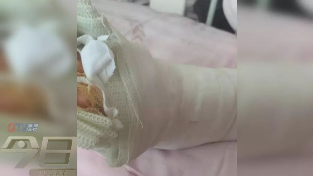 3岁女童商场内被桌子砸脚,趾骨骨折!该由谁来"买单"?