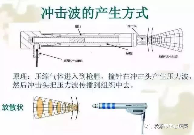 牛河梁健康如此多炎症在瑞士ems放散式体外冲击波治疗仪作用下一笔