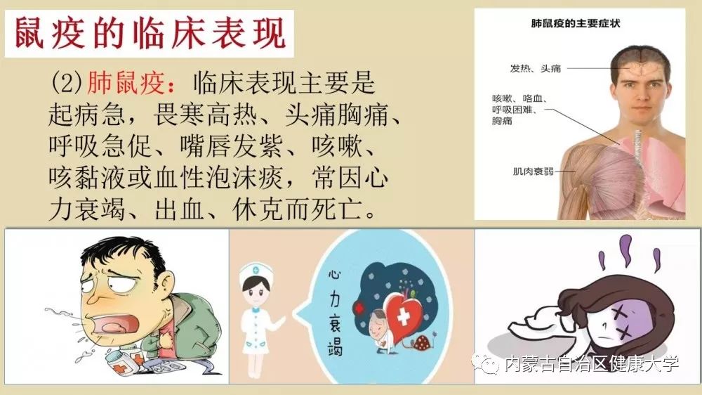 鼠疫可防可治，不必恐慌！