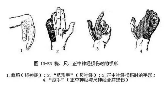 针灸伤到神经怎么办