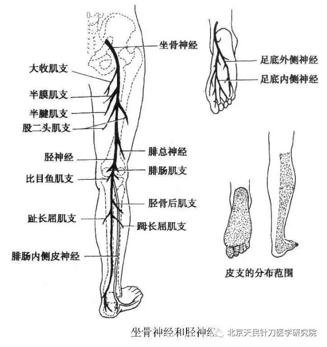 它是指坐骨神经病变,沿坐骨神经通路即腰,臀部,大腿后,小腿后外侧和