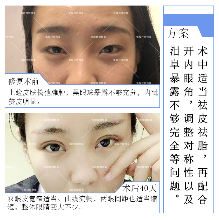 0cc94db11ba44feeae3f427afb8b286a.png