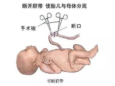 [小皮育儿经]新生儿脐带怎么护理？4点日常行为最易被忽视，新手妈妈值得注意