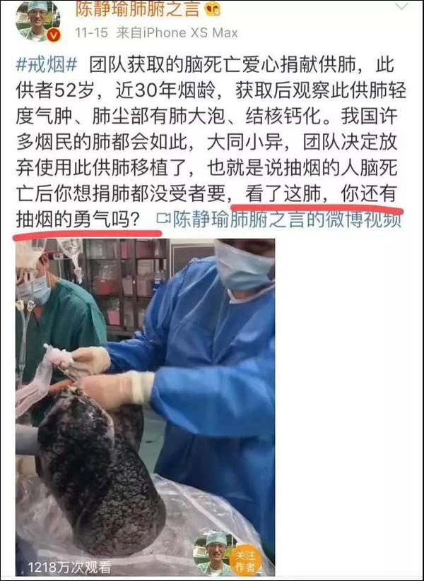 男子捐肺医生取出后放弃使用，图片曝光后吓懵网友