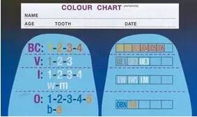 如何判断牙科美学确定比色原则 牙齿比色