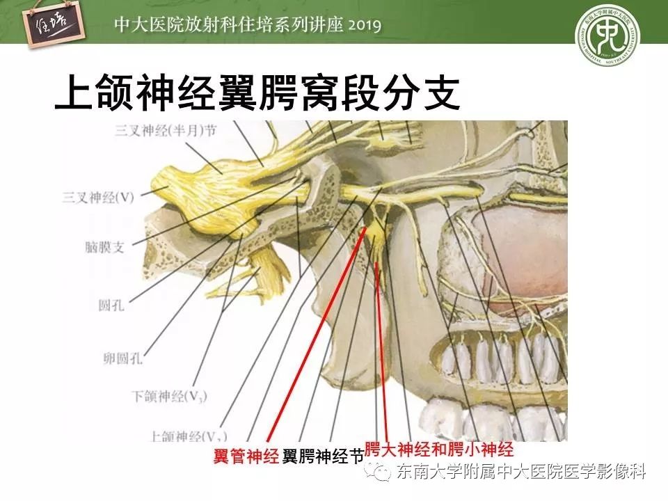 【2019住培系列讲座 第85期】翼腭窝的影像解剖及临床