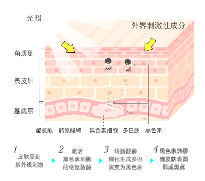 你是怎么变黑的?_黑色素