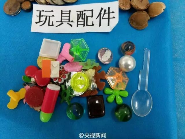 荆州新闻网@监利2岁男童误吞12颗磁力珠危及生命！荆州家长一定要当心这些玩具！