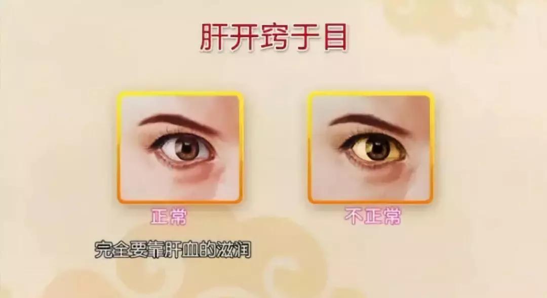 f7ae348ab75f4e9aae4cbb4a6228cafd.JPG