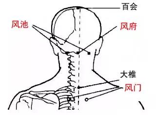 刮痧法的实验原理是什么_中暑刮痧是什么颜色(2)