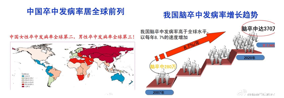 【脑中风及后遗症的治疗现状】