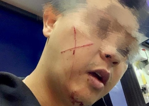 愤怒！香港又有休班警员遇袭脸上被刀划"十字"伤口