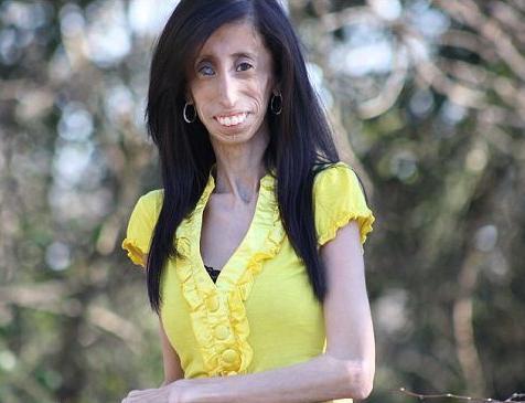 世界上最丑女人——利兹·维拉斯奎兹,人虽丑却很励志