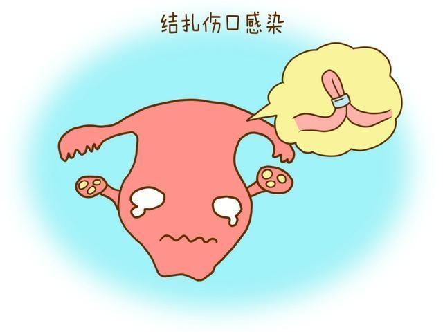                     女性生完娃，是结扎好还是上环好？看看过来人的现状，你就懂了