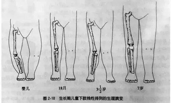 #乐佳善优#如何让宝宝拥有一双笔直大长腿？做到这4点就可以了